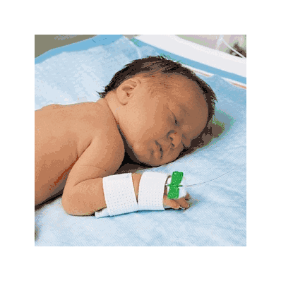 Iv Support Neonatal Armboards - Armboard, Iv,