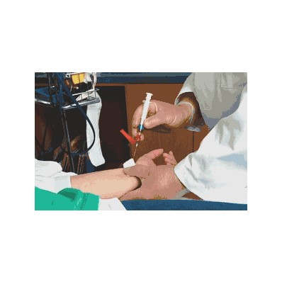Kit, Blood Sampling, Arterial - Kit, BlodD Sa