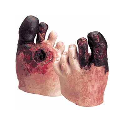 Kit, Unhealthy Foot Care, Life / Form - Medli