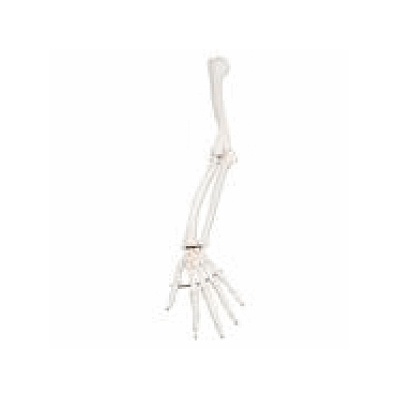 Left Arm Skeleton