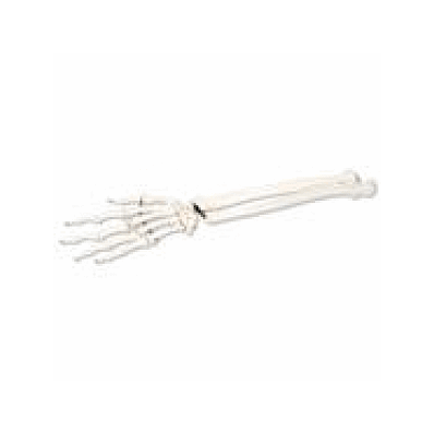 Left Hand Skeleton with portions of Ulna and Radius