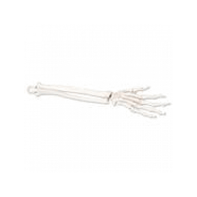 Loose Left Hand Skeleton with Ulna and Radius