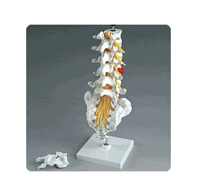 Lumbar Section W/Herniated Dsk - Medline