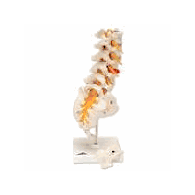Lumbar Spinal Column with Dorso-Lateral
