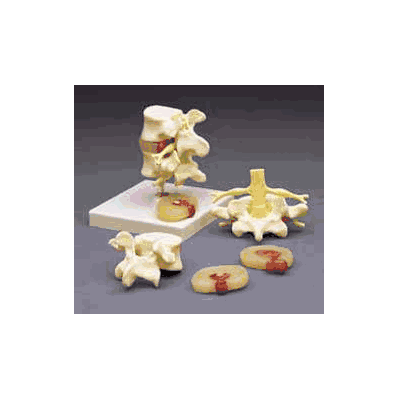 Lumbar Vertebrae Teaching Model - Model, Lumb