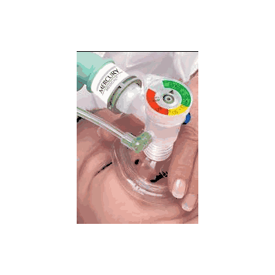 Manometer - Mamometer, Disp (20/Bx) - Mercur
