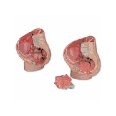MEDart Female Pelvis