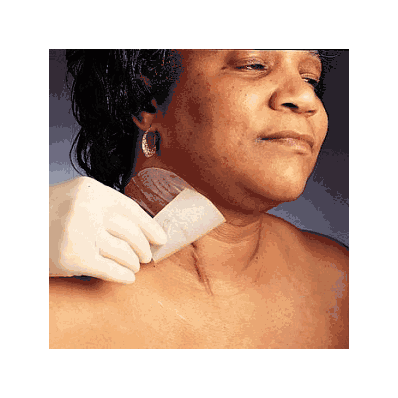 Mepiform, 4" X 7" - Medline