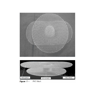 Mesh, Prolene, Soft, 3"X6" - Medline