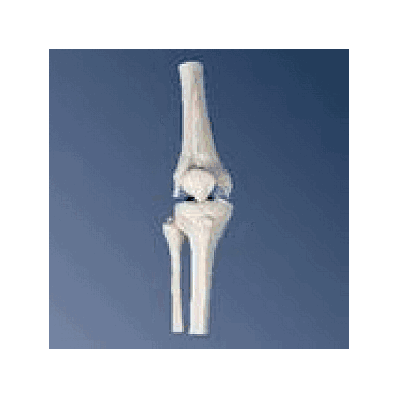 Mini Knee Joint