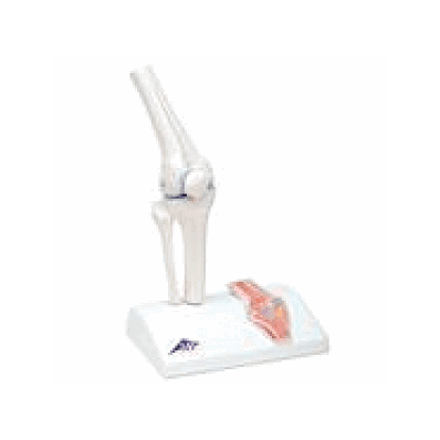 Mini Knee Joint With Cross Section