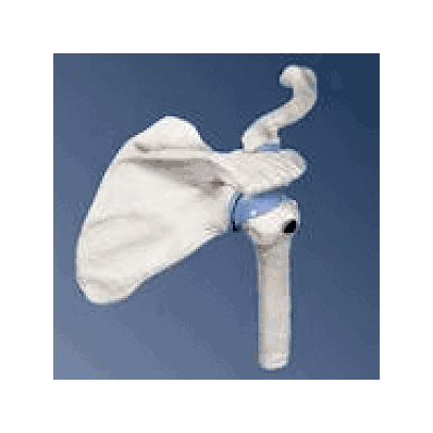 Mini Shoulder Joint