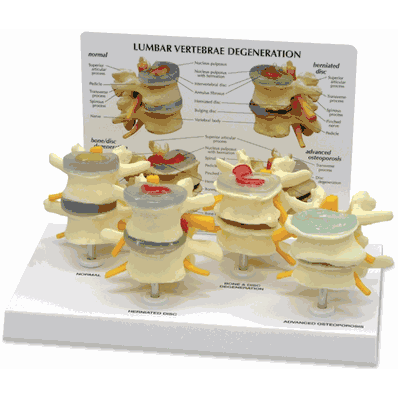 Vertebrae 4-Stage Model