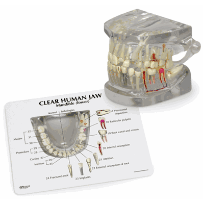 Model, Clear Human Jaw with Teeth