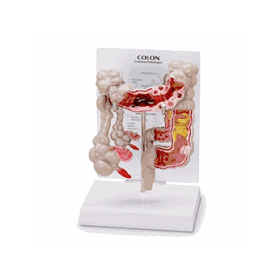 Model, Colon - Medline