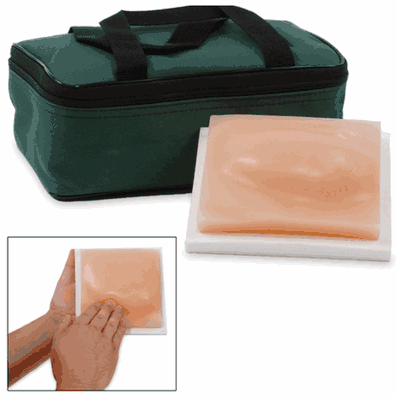 Men'S Breast Cancer Model