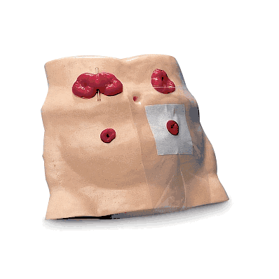 Model, Ostomy Care - Medline