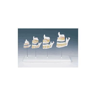 Model, Teeth Dentition Development