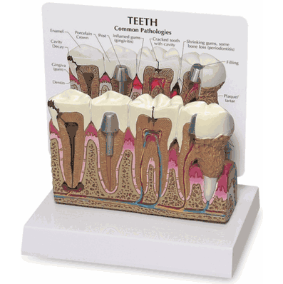 Teeth Model