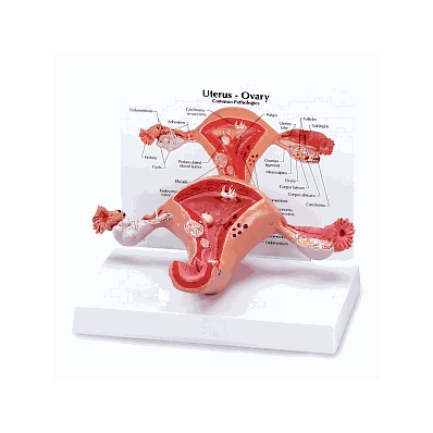 Model, Uterus - Medline