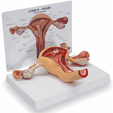 Uterus Model