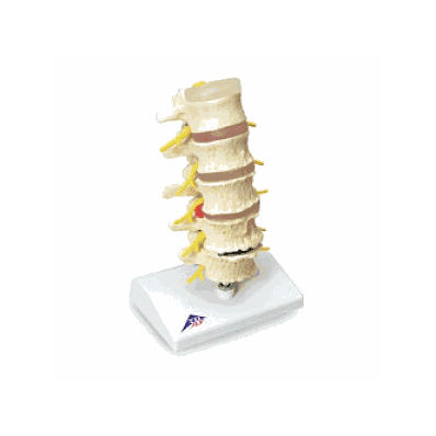 Model, Vertebral, Degeneration, 5 Stages - Me