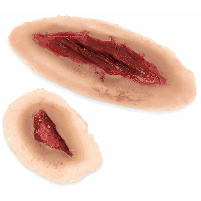 Laceration Basic Lght St 2