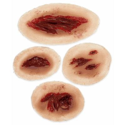Laceration Basic Light Set 4