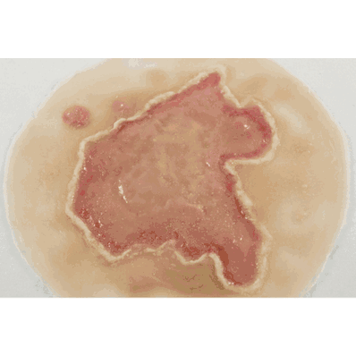 Chemical Burn, Light Set 4