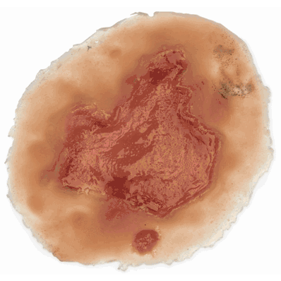 Chemical Burn, Light Single