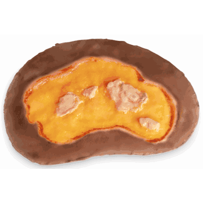 Large Ulcer, Dark Single