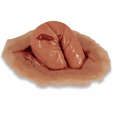 Wound Perforated Bowel Manikin