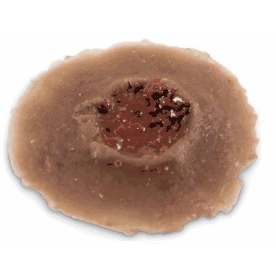 Wound Entrance Single Dark
