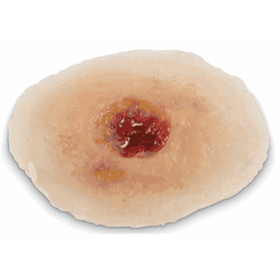 Wound Entrance Light Single