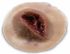 Moulage, Single Gunshot Exit Wound in silicone rubber, color: dark skin, sold as each by MST brand Nasco SB50192D<br><br><font color="red"><b>BACK TO THE PRODUCT TABLE, <a href="https://www.aaawholesalecompany.com/nasco-nursing---medical-simulation-wound-kit.html">CLICK HERE</a></b></font>