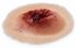 Moulage, Single Gunshot Exit Wound in silicone rubber, color: manikin skin, sold as each by MST brand Nasco SB50192A<br><br><font color="red"><b>BACK TO THE PRODUCT TABLE, <a href="https://www.aaawholesalecompany.com/nasco-nursing---medical-simulation-wound-kit.html">CLICK HERE</a></b></font>