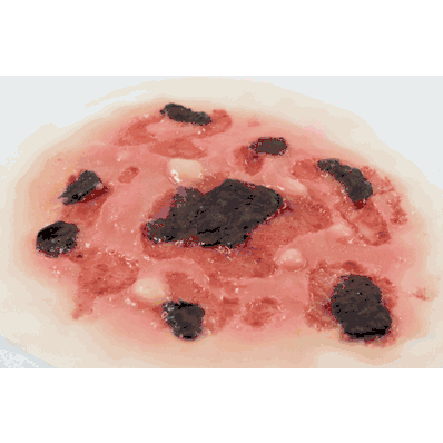 Burn Thermal Lght Single