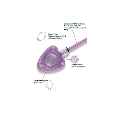 MRI Implantable Port, 8 Fr. Silicone Filled Suture