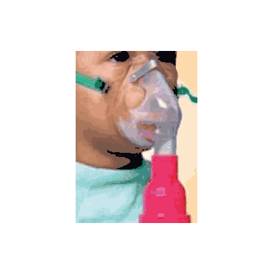 Nebulizer Heart - Nebulizer, Direct Conn Ped