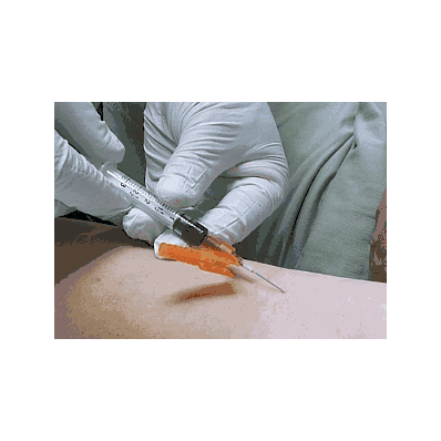 Needle, Hypo, Blood Draw, 20g X 1.5" - Medlin