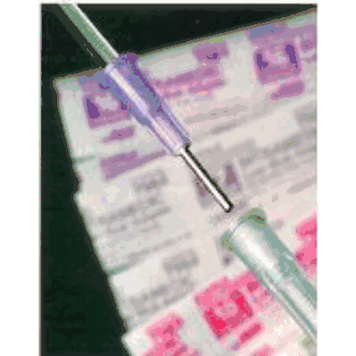 Needle, 15ga 1/2in S / T Ls Adap Cath - Medli