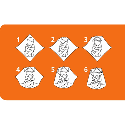 Neodrape Occlusive Fenestrated Sterile D - Me
