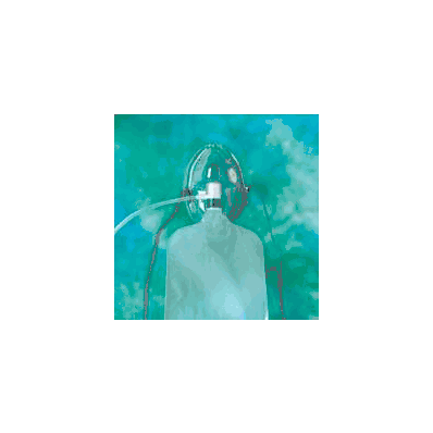Nonrebreather Mask Under The Chin One Size Fi