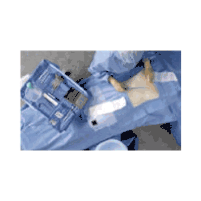  Obstetrics and Gynecology Drape Pack, Peri-Gyn Pack