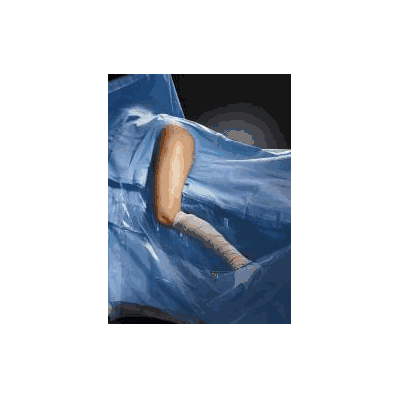 Orthopedic Drape Hip Drape 116 W X 136 L Inch