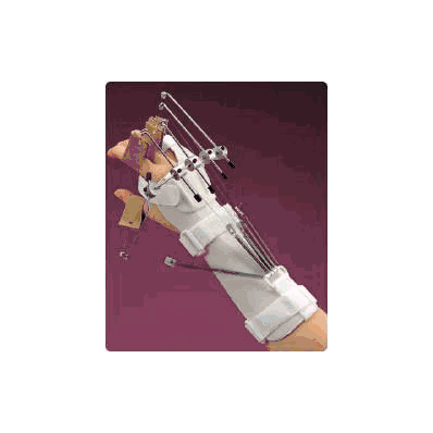 Outrigger Kit Rolyan - OutrigGer Kit, Multi