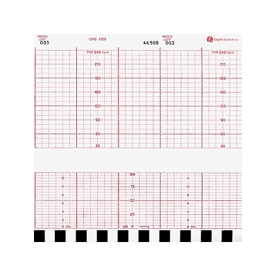 Paper, Ecg, Single Channel, Hp - Medline