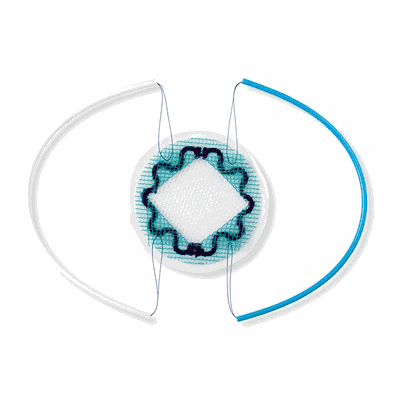 Parietex PCO8VP PCOx Mesh, 8.6 cm Round