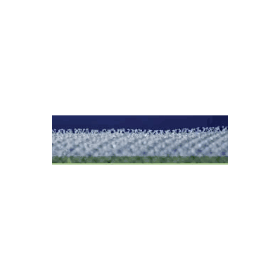 Parietex TEM2015G ProGrip Self-Fixating Hernia Repair Mesh, 15" X 20" Rectangle