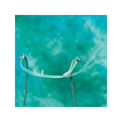 Pediatric Anesthesia Circuits By Teleflx - Ca